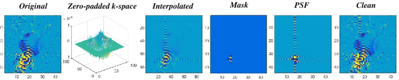 Figure 7. Representative scheme of the REDLIPZ method� . MRSI images for the lipid resonance showing from left to right: 