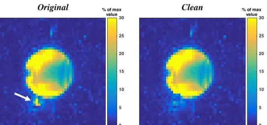 Figure 16. Acetate maps of the phantom data without apodization filter�  before (Original) and after the implementation of the  REDLIPZ  method (Clean)