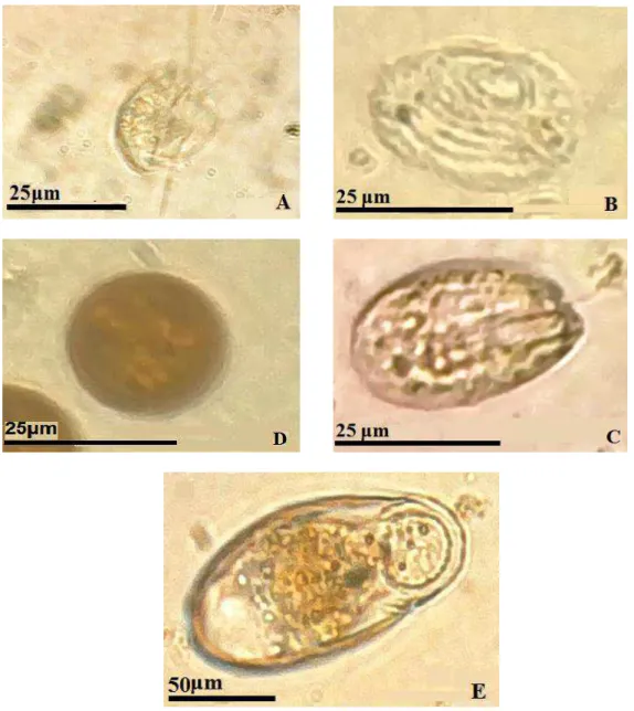 Figura 4. Aspidisca cicada (A); Cinetochilum margaritaceum (B); Entosiphon         sulcatum  (C); Trachelomonas sp