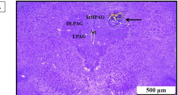 Figura 7. (A) Fotomicrografia do encéfalo de um animal representativo dos grupos mostrando o sítio típico  de  microinjeção  (seta)  na  substância  cinzenta  periaquedutal  dorsolateral  (DLPAG)  na  distância  6,24  mm  posterior  ao  bregma  com  base  