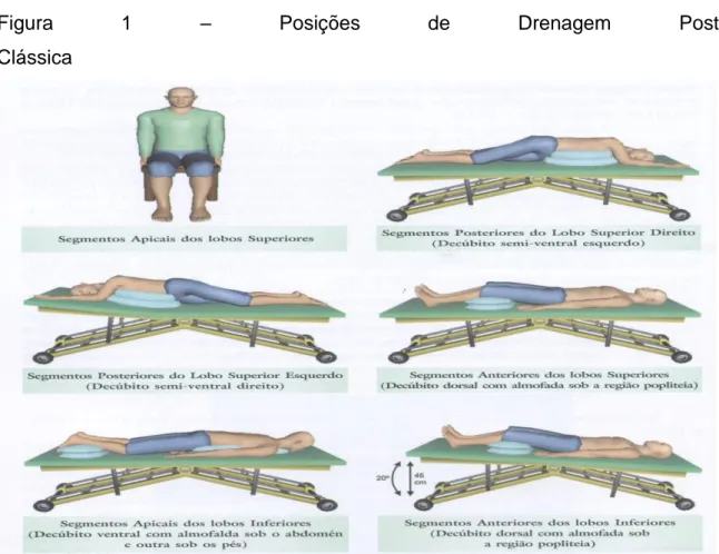 Figura  1  –  Posições  de  Drenagem  Postural 