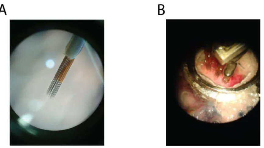 Figure  12.  (A)  Electrode  matrix  (4x4,  250µm  between  electrodes)  (B)  Recording  chamber  and 