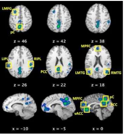 Figura 9  – Regiões de interesse que definem a DMN. LMFG - giro frontal médio esquerdo, pC - pré-cuneus,  LIPL  -  lobo parietal  inferior esquerdo, RIPL  -  lobo parietal  inferior direito, PCC  -  cíngulo posterior, MPFC  -  córtex pré-frontal medial, LM