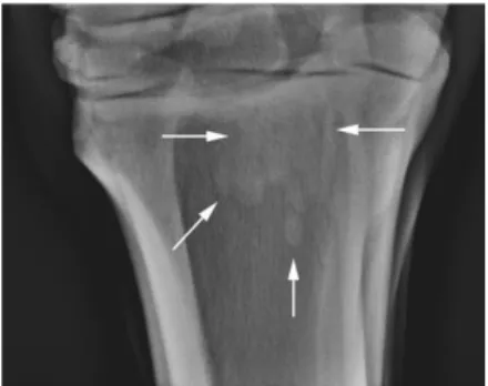 Figura  1.  Imagem  radiográfica  da  região  metatársica  proximal  (projeção  dorsoplantar)