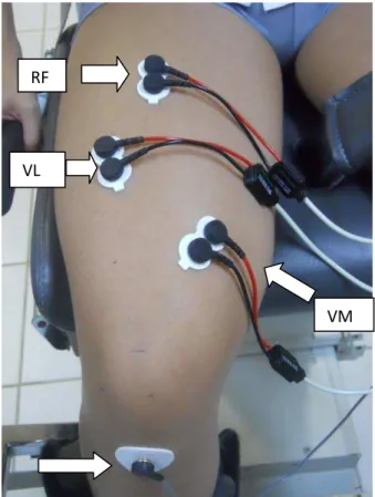 Figura  2.  Posicionamento  dos  eletrodos  nos  músculos  VM,  VL,  RF  e  posicionamento  do  eletrodo  referência  na  tuberosidade  anterior  da  tíbia 