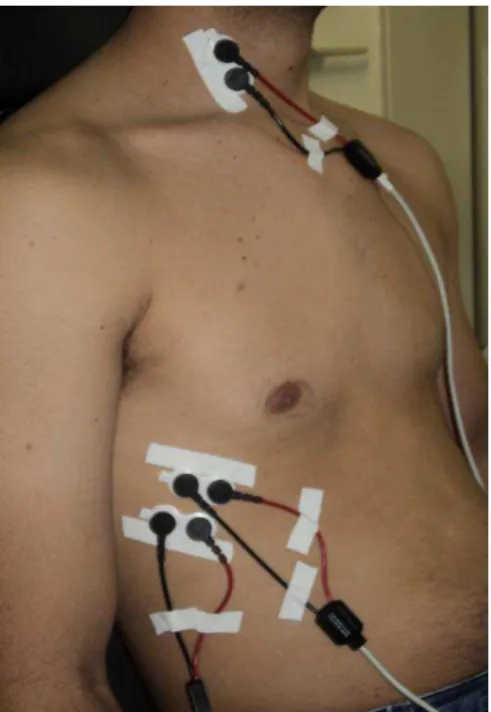 Figura 4: Posicionamento dos eletrodos para registro da atividade eletromiográfica  dos músculos ECM e diafragma