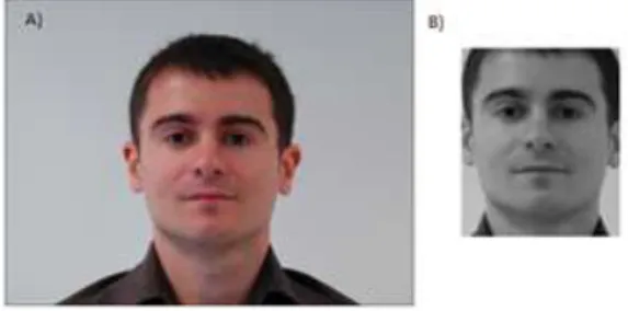 Fig. 2. Result of the geometric normalization. A) Original Image. B) Operation result.