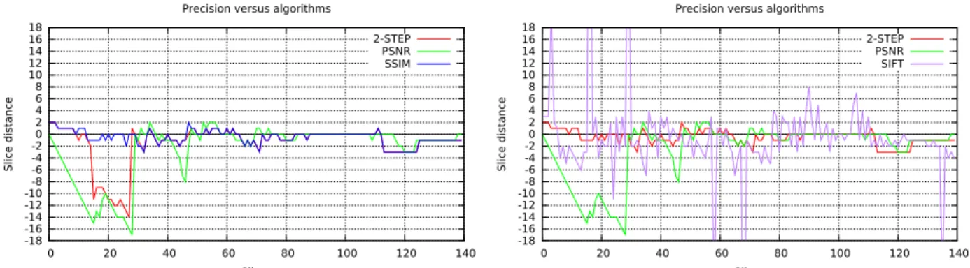 Fig. 3. Precision evaluation. Comparison of venous and late datasets with 256x256x140 resolution in the axial orientation plane