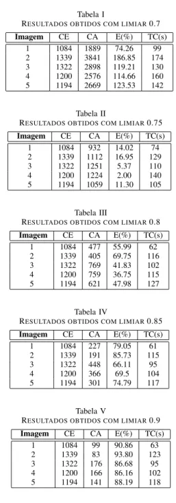 Figura 4. Imagem editada no ImageJ, e que representa a segmentac¸˜ao da regi˜ao de colˆonias bacterianas.