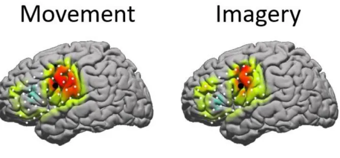 Figure 4 Overlapping cortical activity of motor movement versus movement imagery [39] 