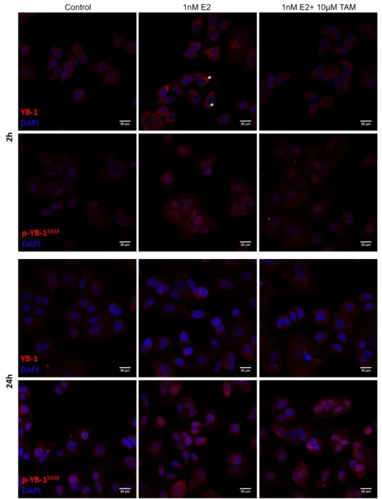 Figure  5  Localization  and  expression  of  YB-1  total  and  phosphorylated  form  under  E2  stimuli