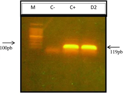 Figura  4.  Resultado  da  reação  da  RT-PCR,  revelada  pela  eletroforese  em  gel  de  agarose
