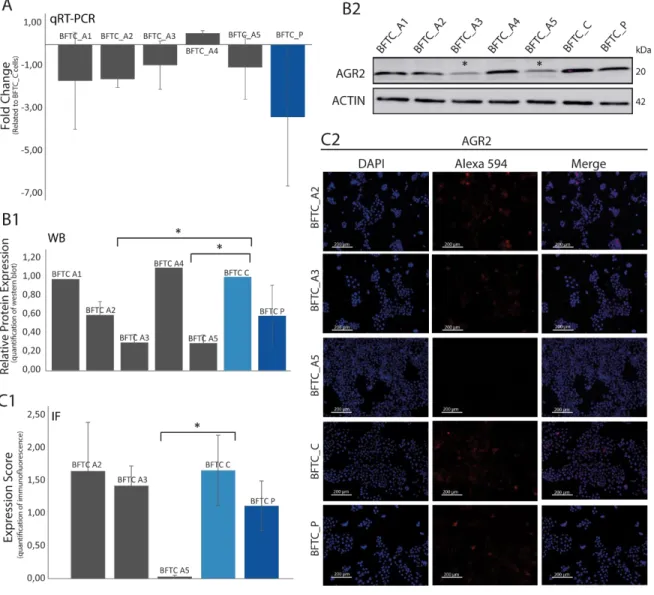 Figure 4.3 mRNA and Protein expression in AGR2 knock down BFTC cell lines (clones A1, A2, A3, A4 and A5)