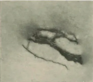 Figura  3 - Registo obtido, por método radiográfico, de uma amostra do minério  pechblenda (Curie, 1910)