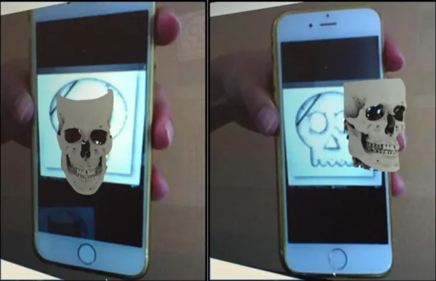 Figure 3 - AR technology applied to a pilot project of distance education in oral radiology using Moodle platform