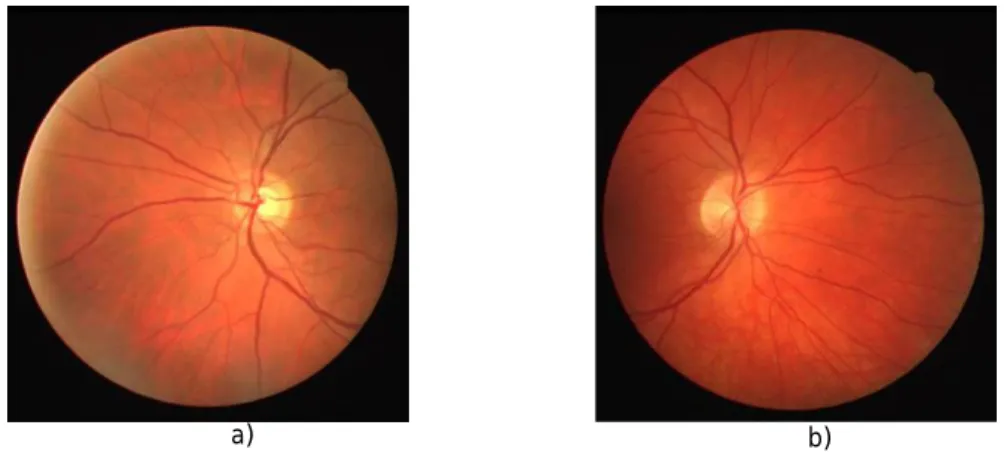 Figura 2.9 – Imagem da retina centradas no DO. a) Olho esquerdo; b) Olho direito. 