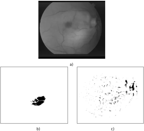 Figura 4.5 – Selecção dos pontos de maior luminosidade na imagem. a) Componente verde da imagem  original; b) Resultado da selecção dos 2,5% pontos mais intensos na componente verde; c) Resultado da 