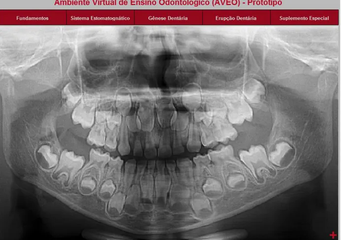 Figura 1 - Menu inicial do programa Ambiente Virtual de Ensino Odontológico (AVEO). 