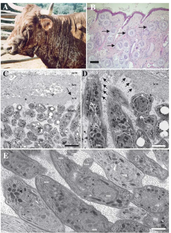 Fig. 1. Besnoitiosis in cattle. (A) A case of besnotiosis in a cow presenting severe besnoitiosis skin lesions