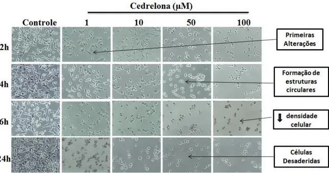 Figura  10-  Efeito da  cedrelona  na  morfologia  das células  tumorais de  mama  da  linhagem MDA-MB-231
