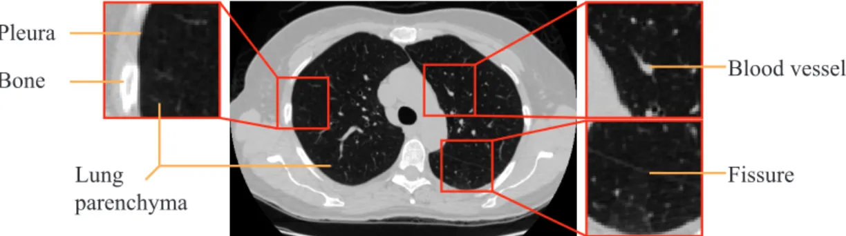 Figure 1.3: Example of a slice from a CT scan. Relevant structures (blood vessels, bone, fissures and lung parenchyma) are depicted