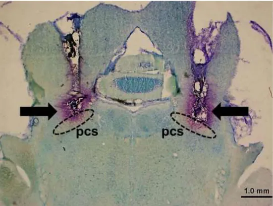 Figura 2 – Fotomicrografia de um corte coronal do encéfalo de um animal representativo dos grupos testados  mostrando os sítios de injeção no NPBL (indicados pelas setas)