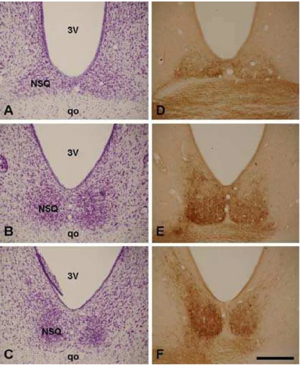 Figura 6. Fotomicrografias de secções coronais através do núcleo supraquiasmático (NSQ) em níveis rostral (A e D), médio (B e E) e caudal (C e F)