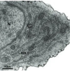 Figura 4. Retículo endoplasmático rugoso (RE) dilatado de fibroblasto, apre- apre-sentando ribossomos aderidos à membrana.
