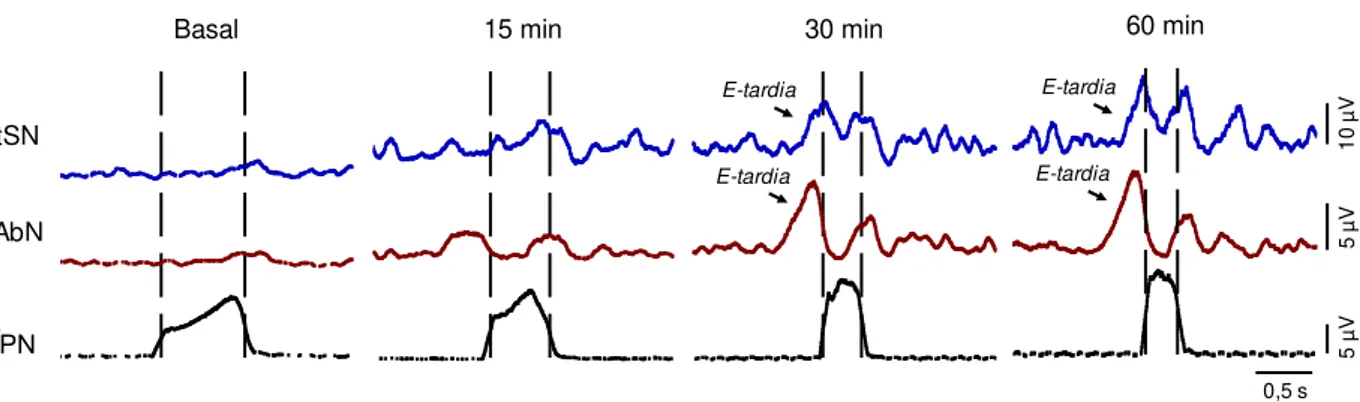 Figura  4.  Modificações  no  acoplamento  simpático-respiratório  após  a  exposição  à  HIA