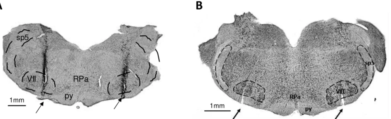 Figura  6.  Sítios  de  microinjeções  no  RTN/pFRG.  Fotomicrografias  de  fatias  do  tronco  encefálico  de  um  animal  anestesiado  (painel  A)  e  de  uma  preparação  in  situ  (painel  B),  representativos dos seus respectivos grupos experimentais,