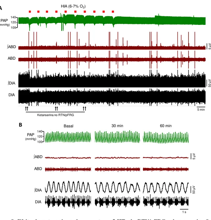 Figura  8.  Efeito  do  antagonismo  dos  receptores  5-HT 2   do  RTN/pFRG  sobre  a  expiração  ativa  induzida  pela  HIA