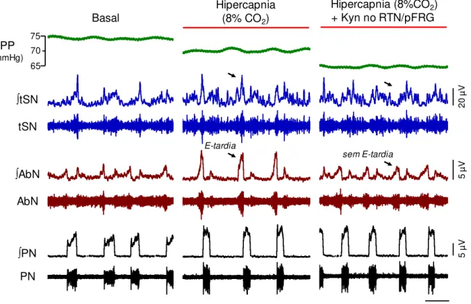 Figura  11.  Efeito  da  microinjeção  bilateral  de  ácido  quinurênico  (Kyn)  no  RTN/pFRG  sobre  atividades  respiratória  e  simpática  durante  hipercapnia  em  preparações  in  situ