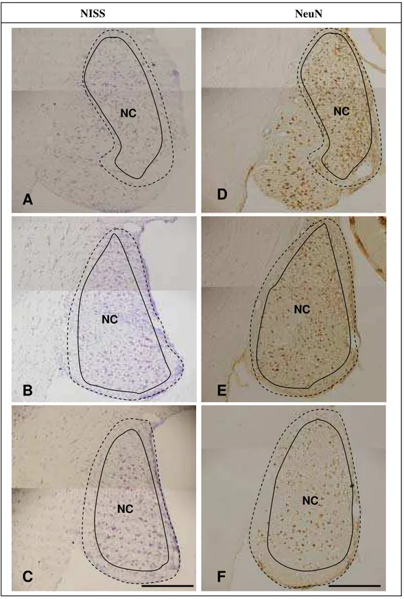 Figura 7. Fotomicrografias em campo claro de secções coronais do NCD do sagüi em níveis rostral, médio e caudal, mostrando a citoarquitetura pelo método de Nissl (A, B e C) e NeuN (D, E e F)