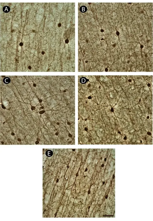 Figura  7  – Células  CR ir no  córtex  pré frontal  do  sagui. A  imunohistoquímica  para CR  revelou  grandes  células  bipolares  caracterizadas  por  apresentarem  uma  orientação  vertical  (figuras A,B e E), células multipolares (C e D)