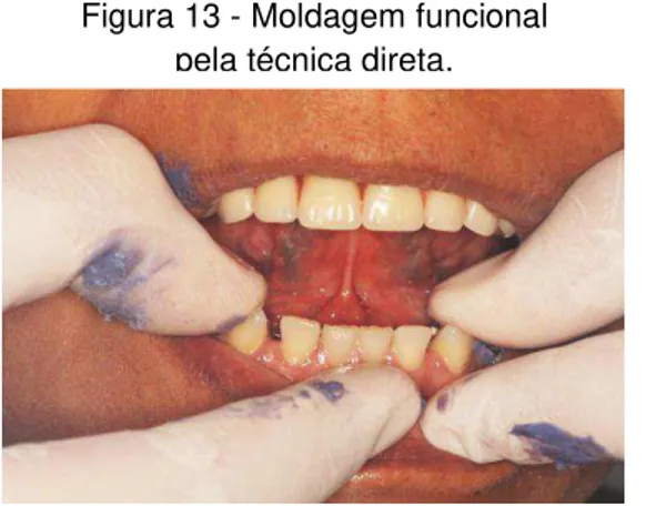 Figura 14 - Verificação da relação  entre os dentes. 