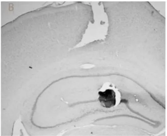 Fig  2:  Photomicrographs  of  a  typical  dentate  gyrus/CA3  and  CA1  cannula  tip 