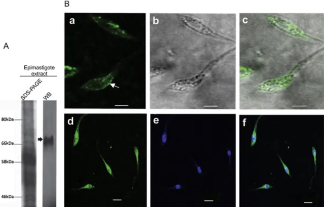Fig. 2. Immunodetection of TcNTPDase-1 inT. cruzi. (A) Western blot (WB) analysis of TcNTPDase-1 expression in epimastigote extract