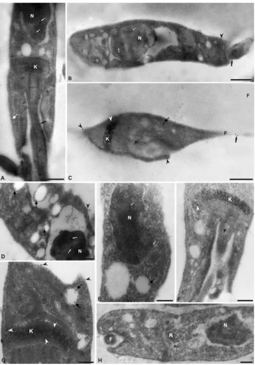 Fig. 3. Ultrastructural analysis of TcNTPDase-1 subcellular localization in epimastigotes