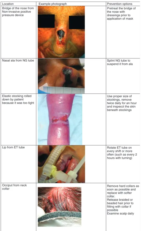 Figure 1 Examples of medical device-related pressure ulcers.