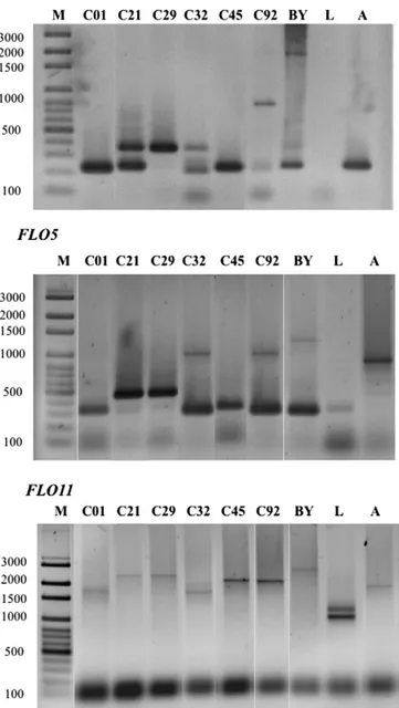Fig. 2. PCR detection of FLO intragenic repetitive domain polymorphisms using primers designed by Verstrepen et al