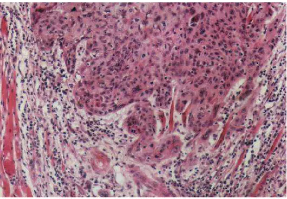 Foto 4 - Detalhe da figura anterior evidenciando-se desgarramento de células 