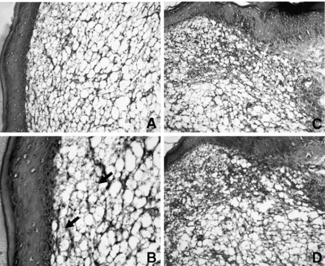 Fig. 5. Representative histology of foot tissues from control and vaccinated IL-12p40 −/− mice infected withL