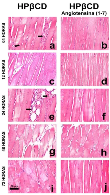 Figura  8.  Fotomicrografias  representativas  de  cortes  histológicos  de  músculo  estriado  esquelético  sóleo  de  animais tratados com o veículo HPβ-CD (a, c, e, g e i) e com formulação de HPβ-CD Angiotensina-(1-7) (b, d, f, h  e j) corados pela Hema
