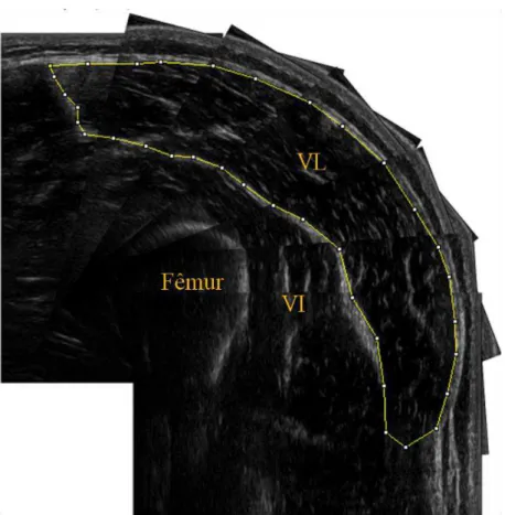 Figura  2.  Imagem  representativa  da  área  de  secção  transversa  do  vasto  lateral  (VL)  mensurada  por  ultrassonografia  e  quantificada  no  software  ImageJ