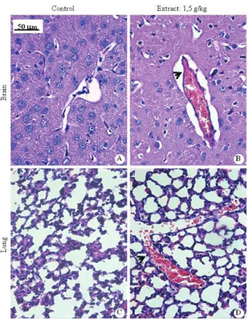 Figure  2.  Photomicrographs  of  brain  and  lungs  of  mice  subjected  to  toxicity  study  of  the  crude  ethanol  extract  of  Lychnophora  trichocarpha