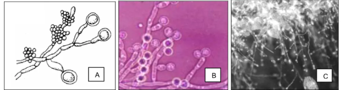 Figura 5: Morfologia da Candida albicans: A) Representação esquemática; B e C) Aspecto  microscópicos, visualizando os clamidosporos e as pseudohifas