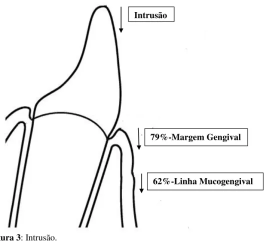 Figura 3: Intrusão. 