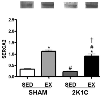 Fig. 8. SERCA protein expression levels in sedentary rats and rats subjected to exercise training