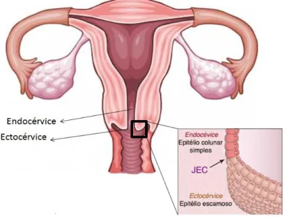 Figura 1. Endocérvice e ectocérvice. Junção escamocolunar (JEC) 