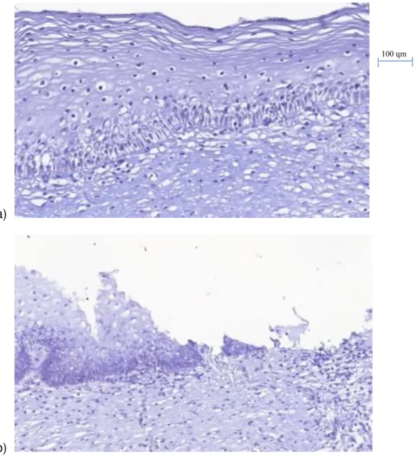 Figura  6.1.  Grupo  controle.    Imunomarcação  das  porções  das  amostras  Controle  (0%  de  imunomarcação)  a)  Epitélio estratificado (endocérvice) e tecido conjuntivo b) JEC e tecido conjuntivo c) Epitélio colunar e tecido  conjuntivo d) Glândulas 